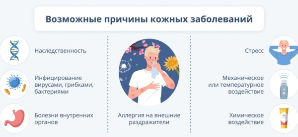 Медицинский портал Dermatologys.ru: заболевания и лечение