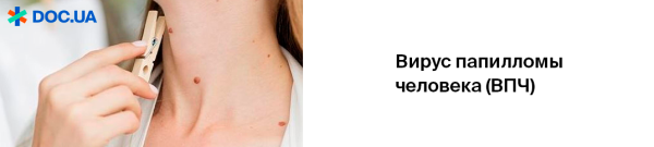 Можно ли заразиться папилломой через поцелуй?