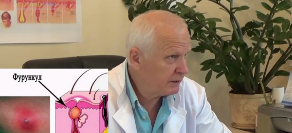 Гнойный фурункул: особенности недуга и лечение