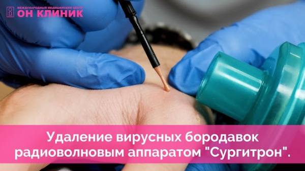 Папилломы при беременности: причины и последствия