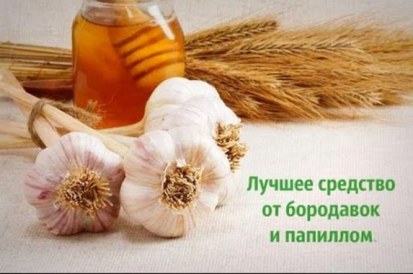 Лечение бородавок народными средствами в домашних условиях