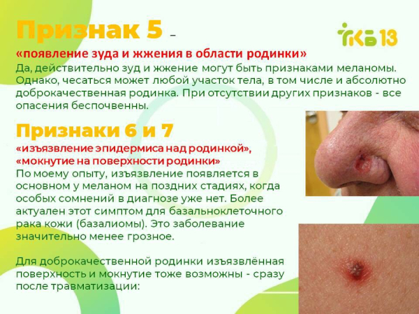 Красная бородавка на коже: что делать?