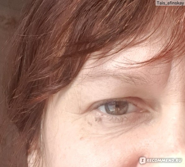 Как удалить папилломы касторовым маслом: применение и отзывы