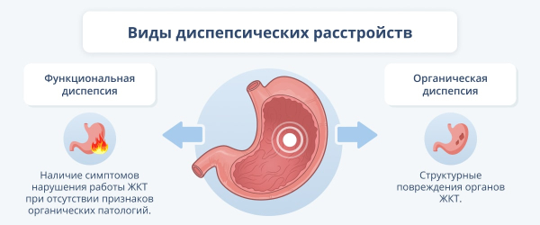 Диспепсия: причины, симптомы и методы лечения