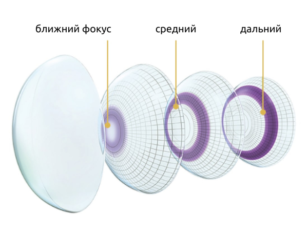 Пресбиопия: причины, симптомы, лечение, профилактика
