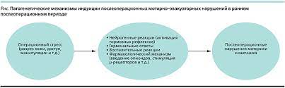 Парез кишечника: причины, симптомы, лечение, профилактика