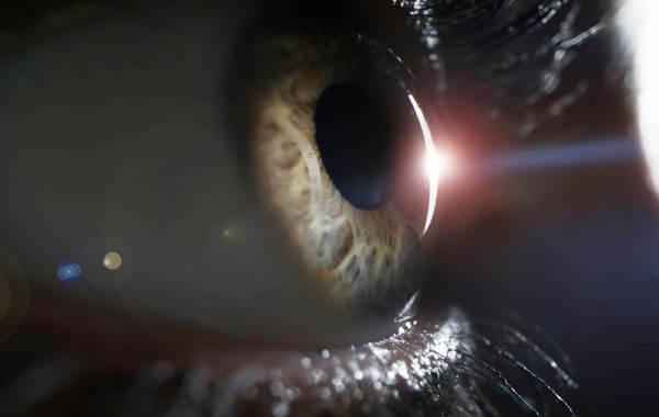 Отслоение сетчатки: причины, симптомы, лечение, профилактика