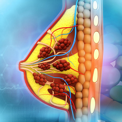 Лечение папилломы молочной железы народными средствами