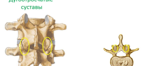 Синостоз: причины, виды, симптомы, лечение