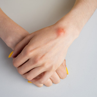 Гигрома у ребенка: причины, симптомы, лечение