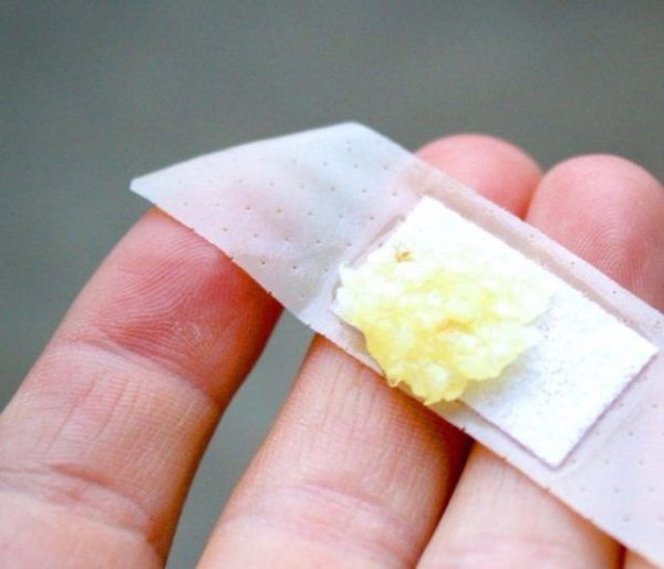 Как вылечить бородавку: рецепт с уксусом и мукой