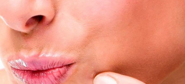 Как избавиться от бородавок на губе у ребенка