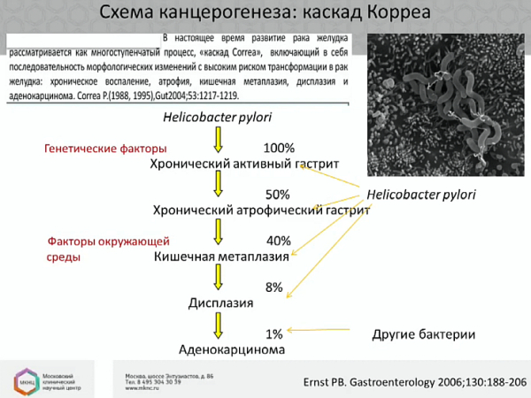 Атрофический гастрит: причины, симптомы, лечение