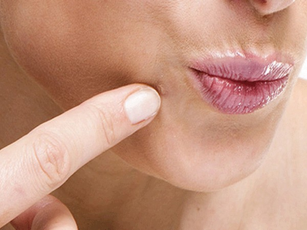 Папиллома на губе у ребенка: причины и лечение