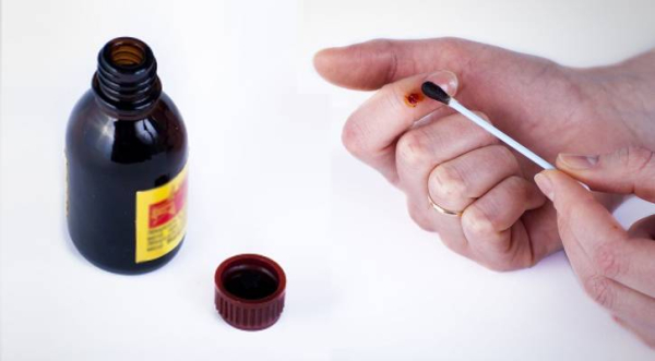 Как вывести бородавки в домашних условиях с помощью чистотела