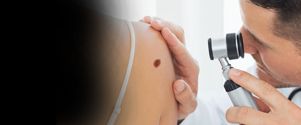 Папилломы на лице у ребенка: причины, симптомы и лечение