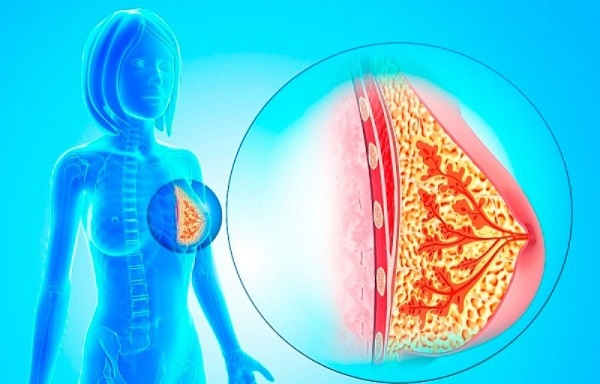 Лечение папилломы молочной железы народными средствами