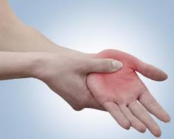 Бородавки на руках: причины, симптомы, диагностика и лечение