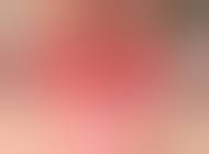 Папиллома в заднем проходе у женщин: причины и лечение