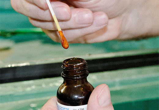 Лечение бородавок йодом: особенности, правила применения и отзывы