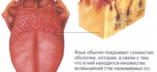 Бородавки на языке: причины и лечение
