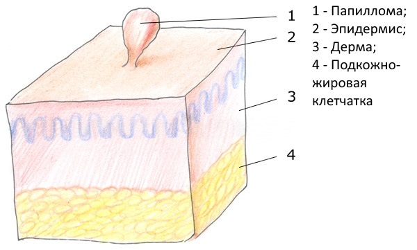Может ли папиллома перерасти в рак?