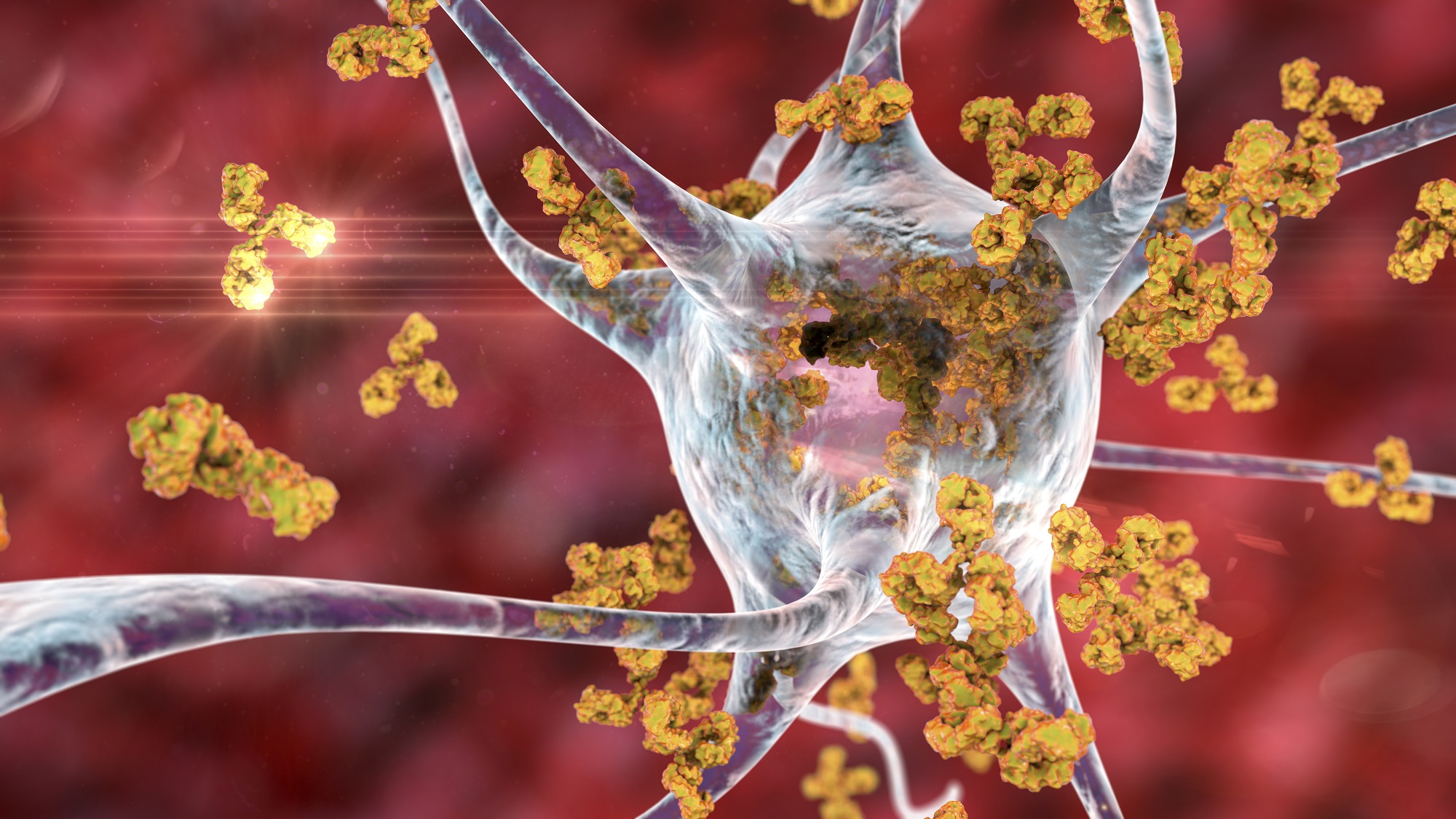 Аутоиммунные заболевания