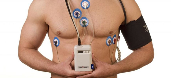 Холтеровское мониторирование (холтер-мониторинг) ЭКГ и АД: показания, проведение, цена, результат