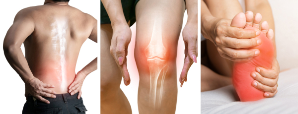 Артроз: лучше ходить или покоиться?